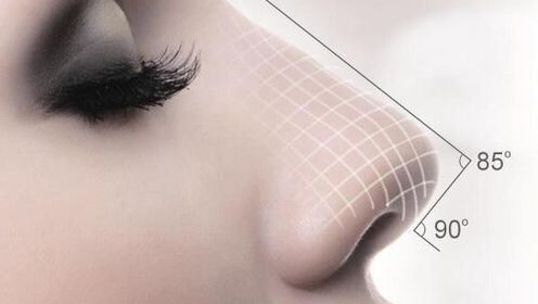 突破查詢限制！深圳藝星整形醫(yī)院經(jīng)驗(yàn)與醫(yī)療名師共同分享，自體脂肪隆胸案例淺析