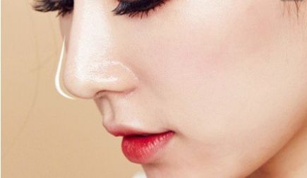 上海九院王俊芳的雙眼皮手術(shù)效果如何？暢覽最新治療案例