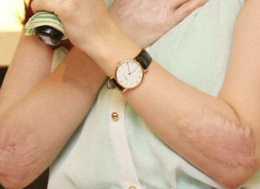 廣州醫(yī)療整容醫(yī)院余文林醫(yī)生在行業(yè)中的評價如何？敬請關(guān)注