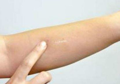 重慶新橋醫(yī)院耳再造專家王韶亮_2023體驗(yàn)案例披露