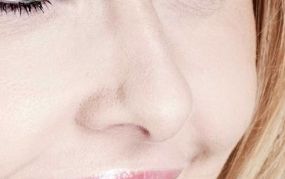 東莞華美美容醫(yī)院主治專家揭秘：主任醫(yī)師手法高明、臨床經(jīng)驗(yàn)豐富案例分享