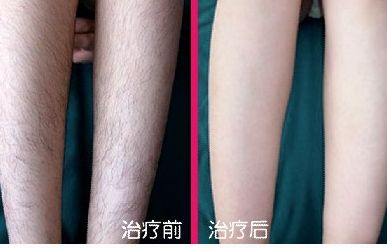 整形醫(yī)生蘇凱、男神張真、王杰大夫誰在鼻部修復(fù)領(lǐng)域頗具聲望？