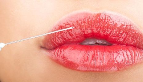 李正勇醫(yī)生乳房整形的最新進(jìn)展，2023案例盡在眼前