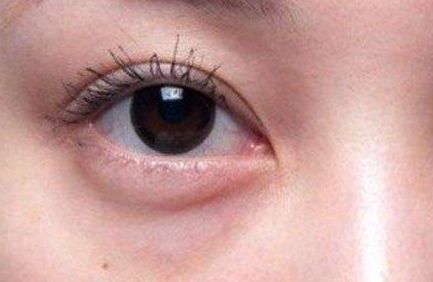 南京隆鼻術(shù)咨詢：熱門醫(yī)生推薦名單發(fā)布！備受歡迎的專家！