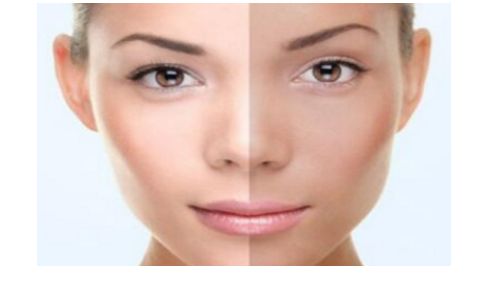 上海伊萊美邱文苑：精湛技藝呈現(xiàn)眼睛完美修復(fù)效果