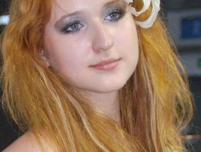 九江風(fēng)華醫(yī)療美容門診部：經(jīng)典案例分享，偷走你的目光！