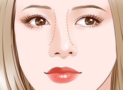 雙眼皮美容手術(shù)在蘭州亞韓整形醫(yī)院如何呢？