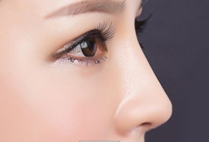 哈爾濱王濱福雙眼皮技術(shù)如何？專家簡(jiǎn)介和成功案例展示！