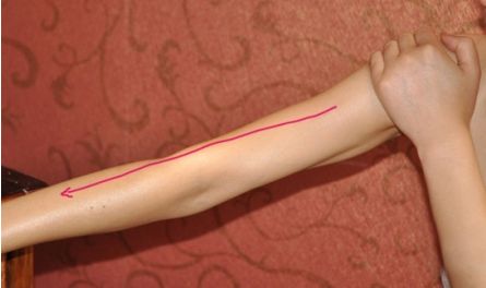 黃海濱醫(yī)生的技術水平如何？分享我的隆鼻手術全過程！