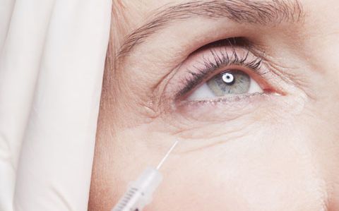 菏澤劉明生雙眼皮技術(shù)靠譜嗎？涉及風(fēng)格如何？看看他人的雙眼皮效果吧