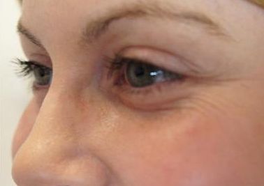 貴陽麗都整形美容醫(yī)院：吳玉家強醫(yī)師出診時間和令人嘆為觀止的隆鼻案例