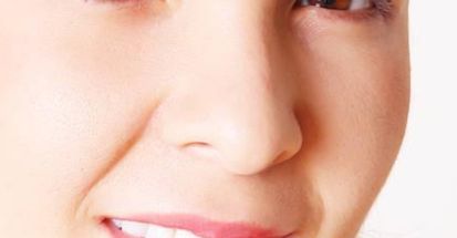 錦繡濟(jì)南潤境孟鑄醫(yī)生鼻部整形案例及價(jià)格更新