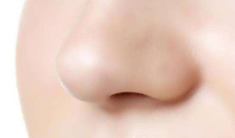 益陽瑞瀾整形，看看他們的雙眼皮效果如何