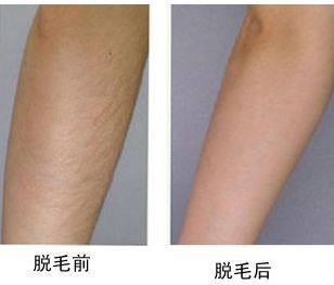 魏璐醫(yī)生隆胸手術(shù)技藝如何？事實調(diào)查與您分享最新見解！