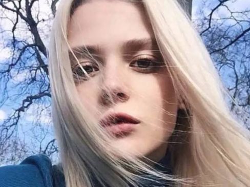 蘇州市立醫(yī)院整形美容科祛除眼袋的成功案例分享