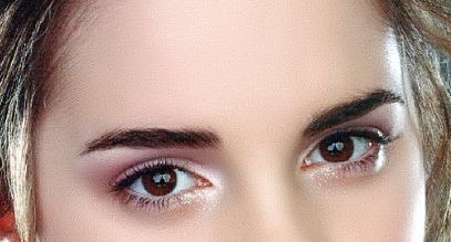 哈爾濱伊美爾醫(yī)院黃志祥醫(yī)生隆鼻手術(shù)費(fèi)用預(yù)估！真實(shí)案例分享讓你了解隆鼻效果！