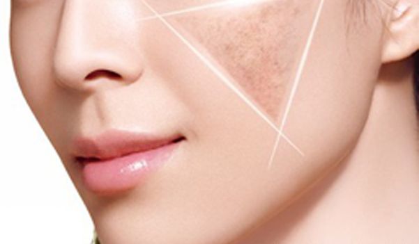 蘇薇潔雙眼皮美容消費(fèi)及可信度分析，上海某醫(yī)院技術(shù)榮譽(yù)洞悉！案例圖欣賞！