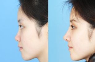 深圳整形醫(yī)生胡華新醫(yī)生擅長的美容手術(shù)項(xiàng)目簡(jiǎn)介