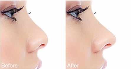 田孝臣醫(yī)生解析，價(jià)格表公開(kāi)附準(zhǔn)確隆胸案例詳解！術(shù)前重要信息披露~