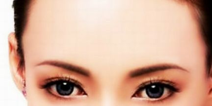 重慶醫(yī)科附一醫(yī)院張恒術(shù)醫(yī)生雙眼皮技術(shù)驗(yàn)真實(shí)過程！