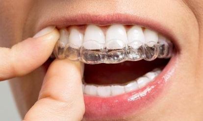 自然修復(fù)雙眼皮方案，了解收費及成功案例，醫(yī)生經(jīng)驗分享