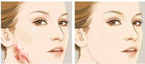 解密上海九院眼部整形高手周—雄醫(yī)生的術(shù)中絕活及成功案例！