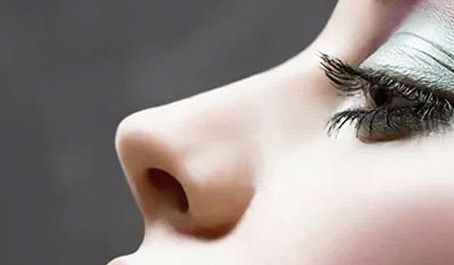 廈門張安利雙眼皮修復經驗分享，效果超乎預期！雙眼皮修復詳解