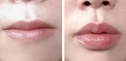 沈陽經(jīng)過篩選的整形醫(yī)院公立醫(yī)院推薦，手術(shù)過程圖解！