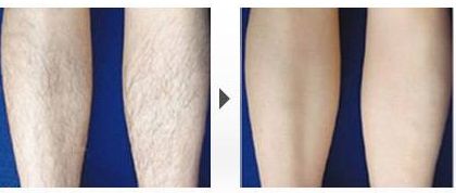 南京張少博醫(yī)生如何進行鼻部整形？經(jīng)驗分享及成功案例分享