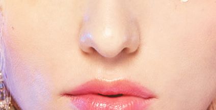 趙軍艦醫(yī)生進行面部脂肪填充效果如何？案例展示供參考