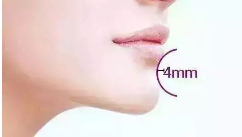 2023年上海最受歡迎的隆胸醫(yī)生排名！詳細(xì)介紹馮少清、董佳生、江華醫(yī)生