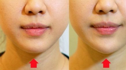 江蘇省人民醫(yī)院整形科醫(yī)師陣容強(qiáng)大！他們實(shí)力可嘉，不容錯(cuò)過！