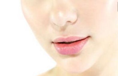 吉林大學(xué)第一醫(yī)院整形科雙眼皮最近有什么新進(jìn)展？案例分享