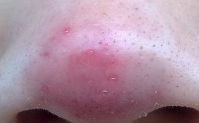 金華雙眼皮手術(shù)，哪位醫(yī)生值得信賴？專家評(píng)選揭曉，五位醫(yī)生備受推崇！手術(shù)攻略與價(jià)格一覽！