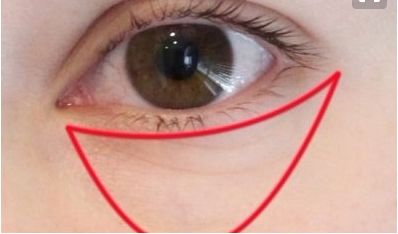 上海仁愛整形劉先超鼻子效果如何？好評案例詳解，價(jià)格咨詢！