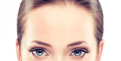 王光輝醫(yī)生雙眼皮術(shù)后80天恢復(fù)情況詳解