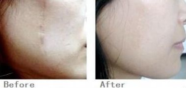 2023杭州鼻骨整形專家排名披露，名醫(yī)排行大揭曉！