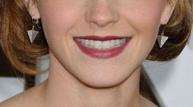 年度最佳技術(shù)大揭秘！龍劍虹注重細(xì)節(jié)，讓雙眼皮優(yōu)雅呈現(xiàn)