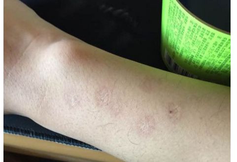 青島雙眼皮大師孫好杰：醫(yī)術(shù)精湛，技術(shù)贊嘆！醫(yī)生背景揭秘！