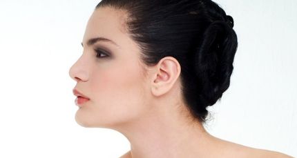 成都玉之光劉中國醫(yī)生手術(shù)后效果非常出色！