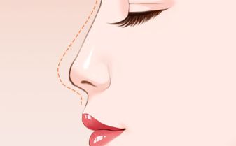 韓國兩位醫(yī)生對比，顴骨整形案例全解析！