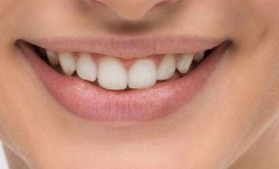 上海倪鋒醫(yī)生拉皮手術(shù)效果如何？百達麗知名醫(yī)療專家揭秘，真實案例分享！