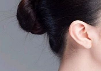 山市人民醫(yī)院雙眼皮技術(shù)實(shí)力如何？?jī)r(jià)格參考表