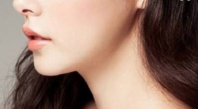 裴柄萬為您割的雙眼皮效果如何？點擊查看恢復(fù)期對比圖，附有價格表！