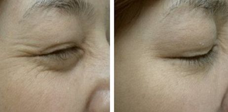 上海九院豐脂達(dá)人薈萃！5大醫(yī)師攜超前審美領(lǐng)航，個人簡介與收費(fèi)揭秘~