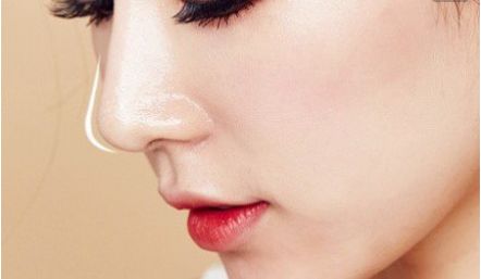 西京醫(yī)院宋保強：開啟雙眼皮之美，醫(yī)生實力及成功案例詳解