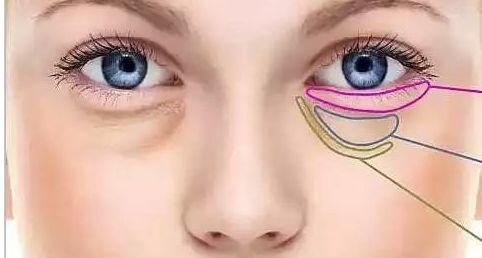 中國(guó)醫(yī)學(xué)科學(xué)院整形外科醫(yī)院劉珍君醫(yī)生的腰腹吸脂技術(shù)能力如何？分享一例成功案例