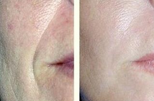 2023年最新分享！揭秘八大處范飛醫(yī)生引領的革命性隆鼻技術