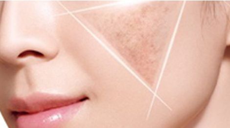 《泉州首屈一指的醫(yī)院-吳曉紅醫(yī)師如何進行掛號？帶你領(lǐng)略鼻修復(fù)案例+個人背景賞析》