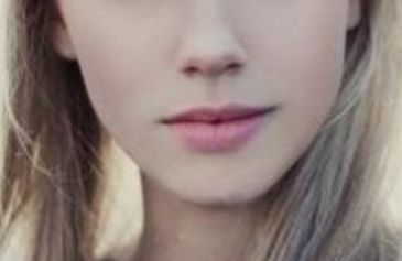 昆明韓辰醫(yī)療美容醫(yī)院的面部脂肪填充效果如何？案例一覽引領新潮流